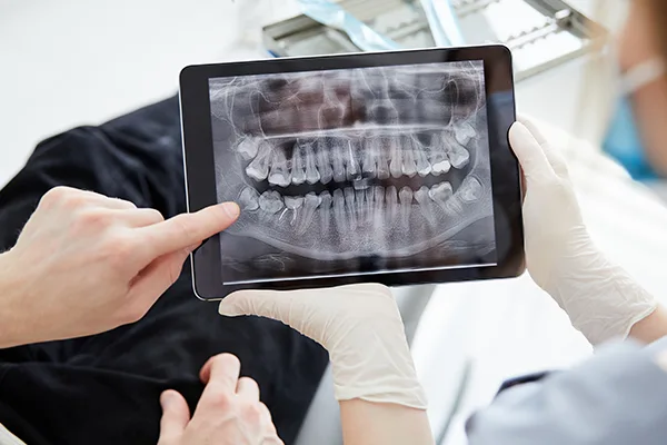 Dental X-rays