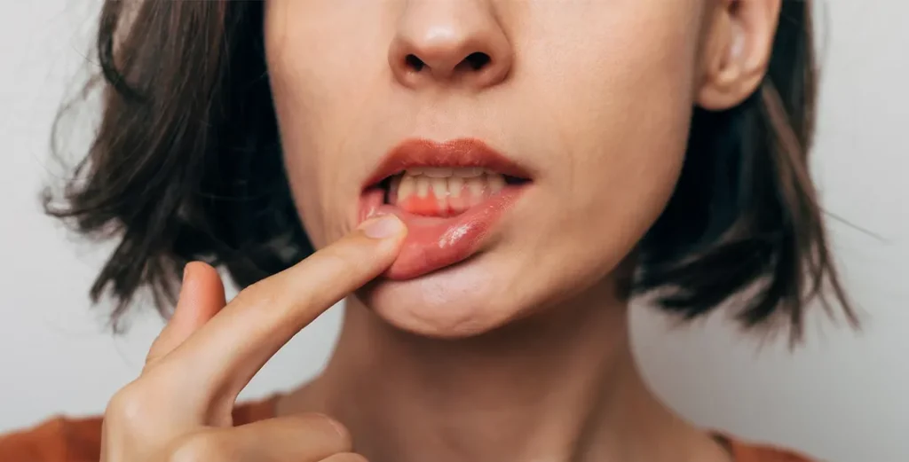 Periodontal Disease Treatment